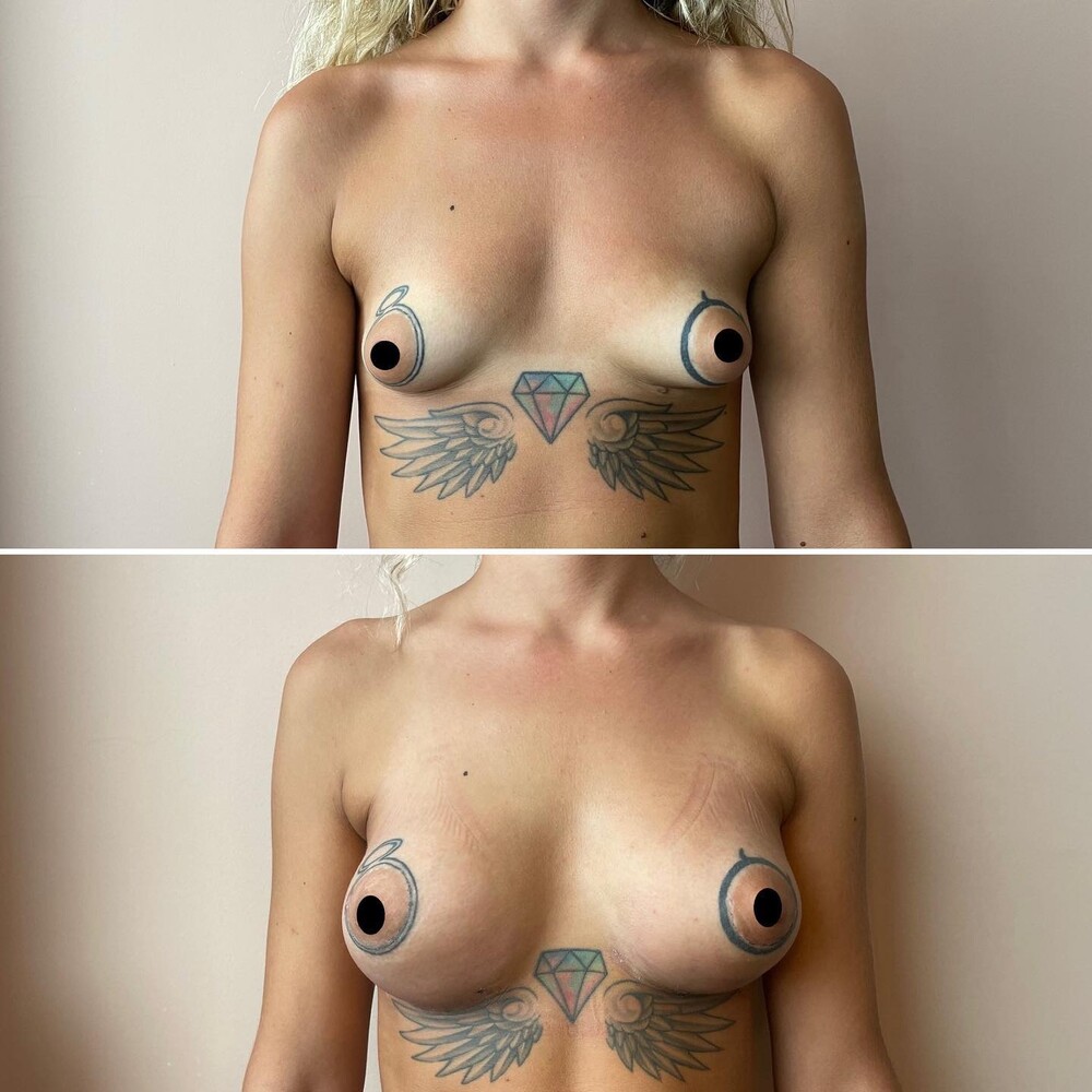 Clinic Results Gallery